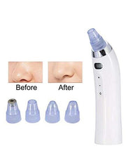 4 in 1 Blackhead Remover Pore Vacuum